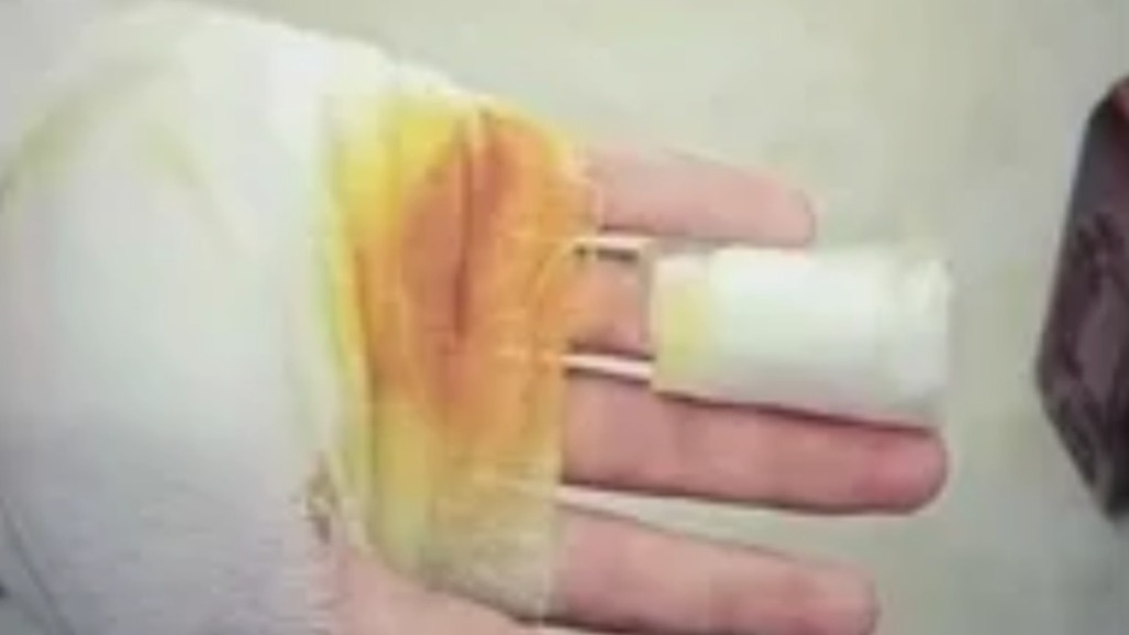 马上评｜中学生被操场地面烫伤	，谁的“大课间	”？  第1张